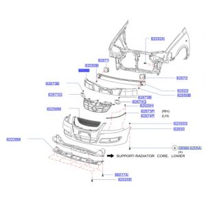 حشوة صدام امامي